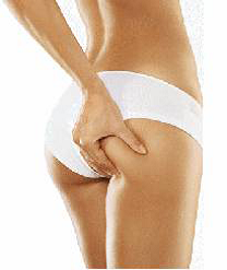 non-surgical liposuction bottom