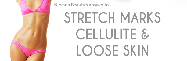 Stretch Markes/ Cellulite
